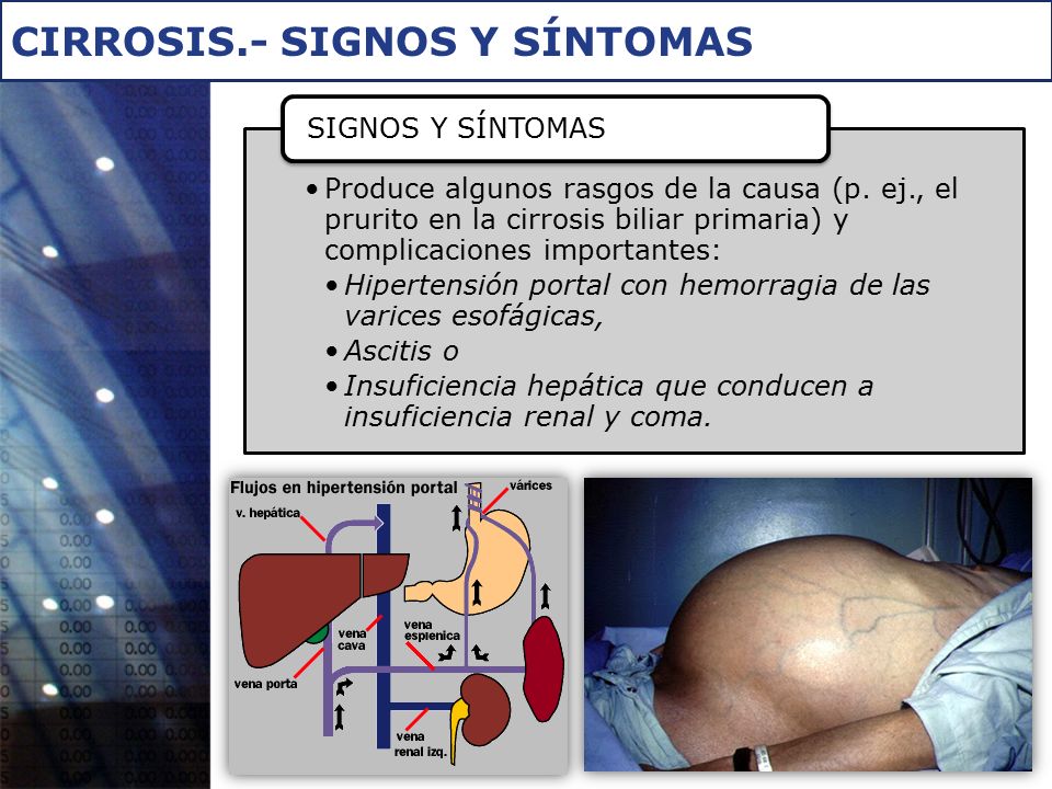 Hepatica avanzada sintomas de cirrosis